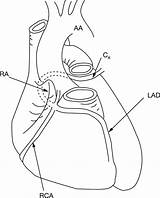 Heart Coronary Sinus Ostium Right Anatomy Arteries Figure sketch template