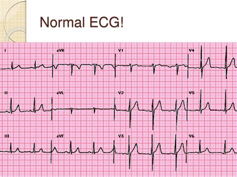 ecg rygb hot sex picture
