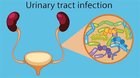 E Coli And Urinary Tract Infections Utis Everyday Health