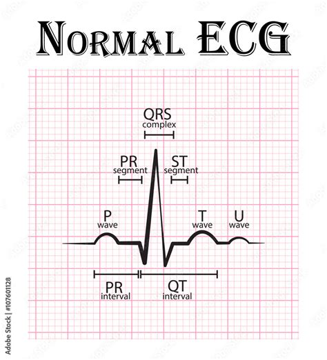 normal ecg electrocardiogram p wave pr segment pr interval qrs complex qt interval