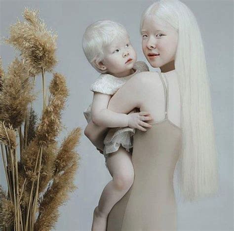 albino kiz kardesler moda duenyasinin ilgi odagi duenyadan haberler