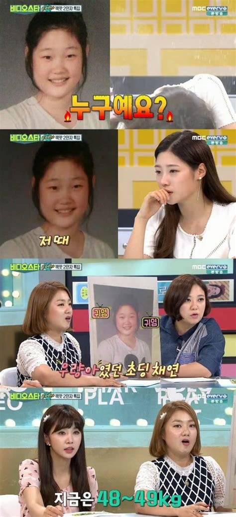 Jung Chaeyeon Confesses She S Had Plastic Surgery On
