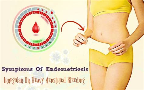 Top 12 Common Symptoms Of Endometriosis Pain