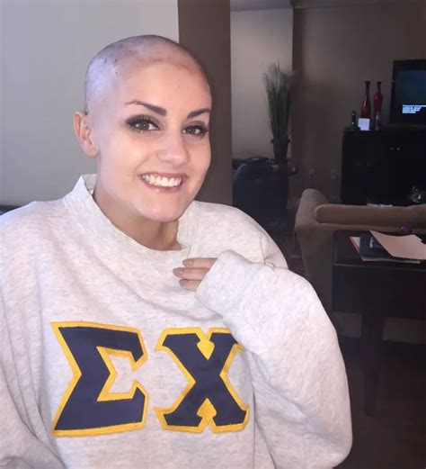 The Teenager Shaved His Head In Solidarity With His Girlfriend With