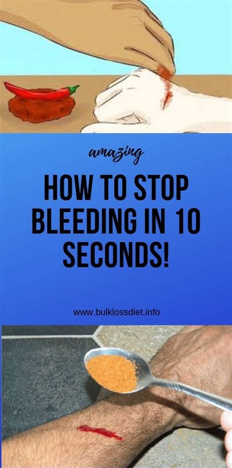 How To Stop Bleeding In 10 Seconds Herbal Remedies Natural Teething