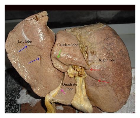 Figure 16 A New Insight Into The Morphology Of The Human Liver A