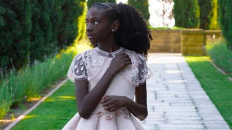 this 11 year old was bullied for her skin color now she owns a