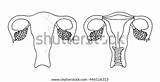 Womb Uterus Ovaries sketch template