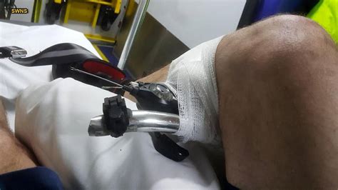 man impaled by bike s handlebars says accident ‘happened so fast fox