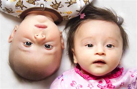 top 10 bizarre and rare types of twins listverse