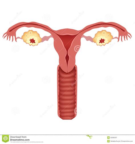 the uterus and ovaries stock vector illustration of inside 52595337