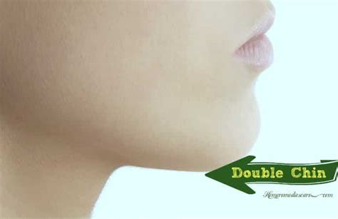 20 best home remedies to get rid of a double chin naturally