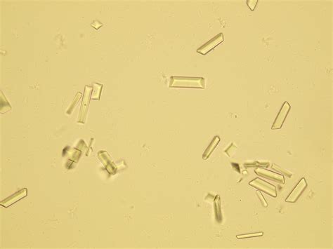 calcium oxalate crystals  urine dog urine phosphate microscopic lf