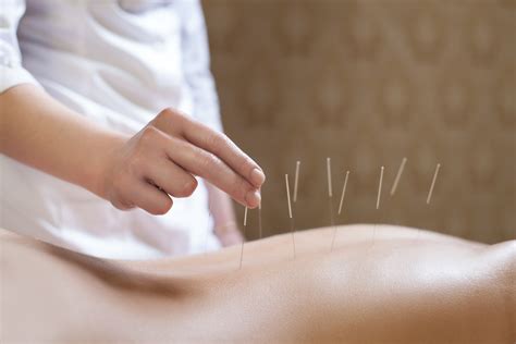 Acupuncture Boosts Effectiveness Of Standard Medical Care For Chronic