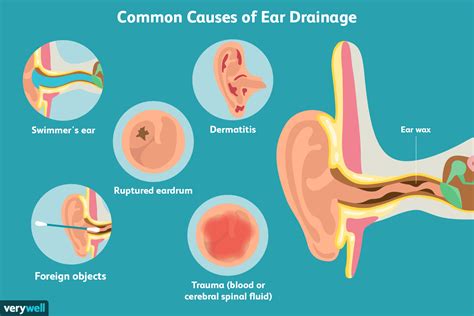 treatment  ear drainage