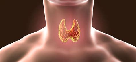 subclinical hypothyroidism symptoms and 3 natural remedies dr axe