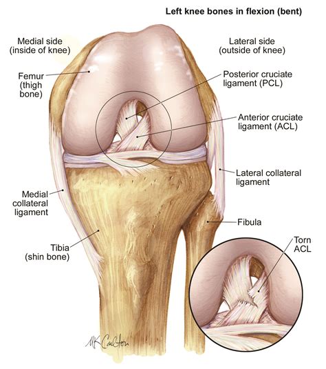 acl surgery return  play  guaranteed momsteam