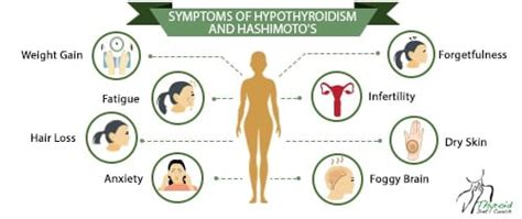 common and not too common symptoms of hypothyroidism and hashimoto s