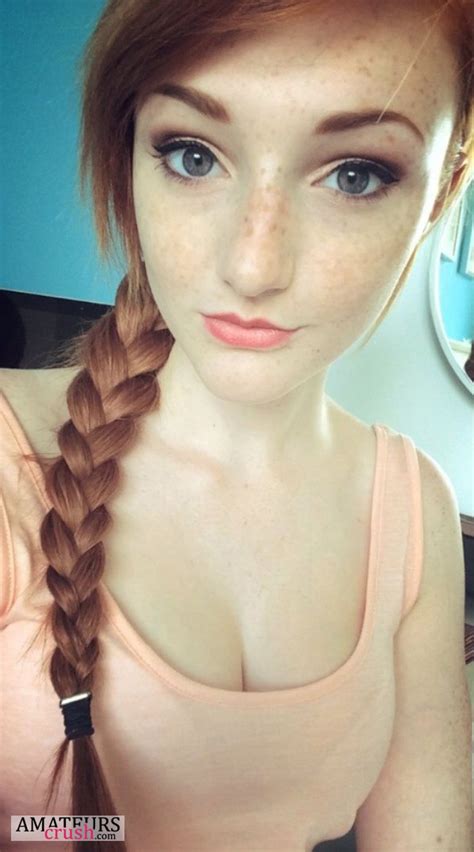 ginger teen freckles