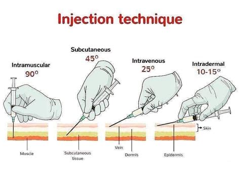 injection types coolguides medical assistant student medical school inspiration nursing