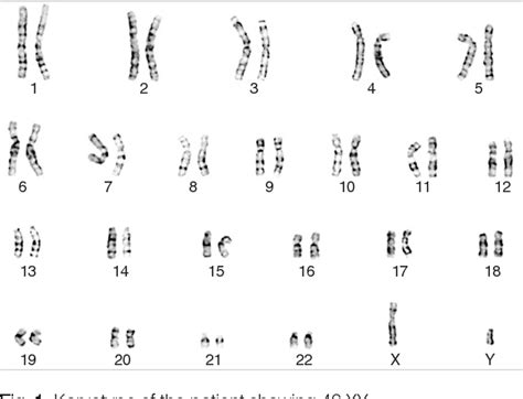Figure 1 From [a Case Of 46 Xy Pure Gonadal Dysgenesis With Loss Of The