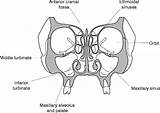 Paranasal Sinuses Nasal Cavities Fig sketch template