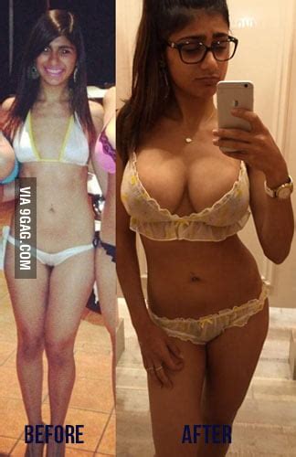 Mia Khalifa Before And After Surgeries 9gag
