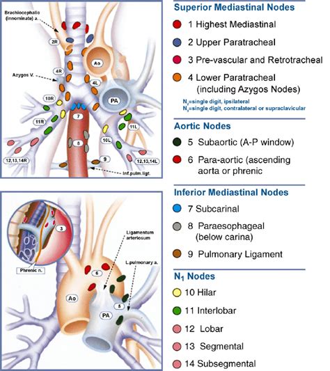 Regional Lymph Node Stations For Lung Cancer Staging [2] With Kind