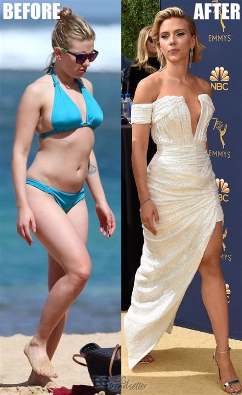 scarlett johansson plastic surgery breast reduction before and after