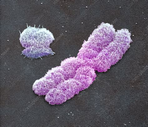 male sex chromosomes sem stock image p656 0172 science photo library