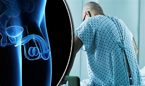Penile Cancer Symptoms Of Disease Linked To Hpv Virus Revealed