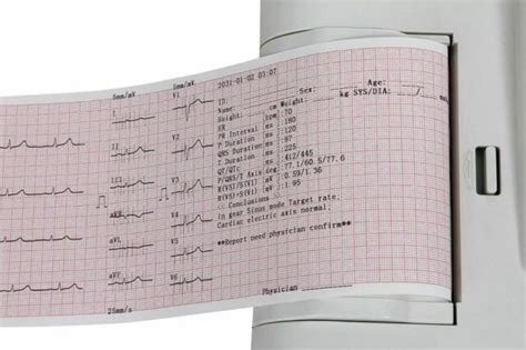Print Paper Roll For Contec Ecg600g Ecg Machine Electrocardiograph