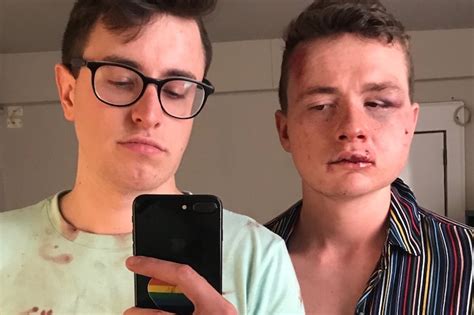 gay couple assaulted robbed on u street in attack that used homophobic