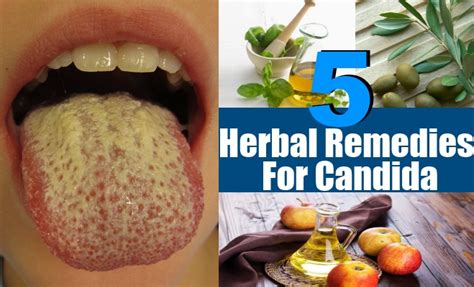 best herbal remedies for candida how to treat candida with herbs