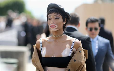 Model Winnie Harlow Responds To Fat Shaming Accusations