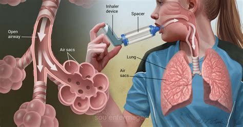 penyakit asma punca gejala  rawatan tcermy