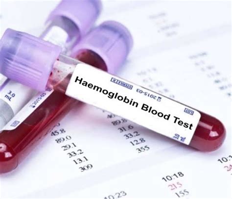 hemoglobin test glovision diagnostics  pune india