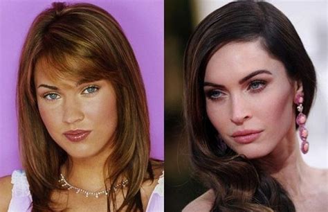 Megan Fox Face Plastic Surgery Chin Lips And Nose