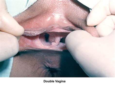 two vaginas sex big teenage dicks