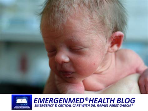 emergenmed health blog el lanugo en fetos  recien nacidos