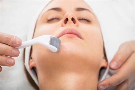 skincare  makeup tips  microneedling skin deep med spa