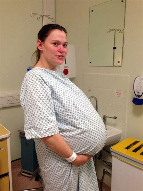 Delighted Couple Beat Odds Of 200 Million To One To Give Birth To