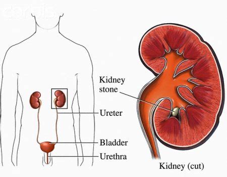 tips   clean  toxins kidneys  bladder health care skin