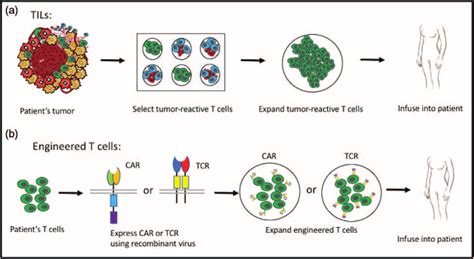 The Processes Of Tumor Infiltrating Lymphocyte Therapy And Engineered