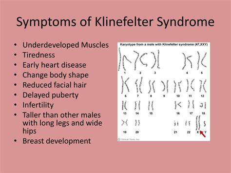 Symptoms Of Klinefelter Syndrome