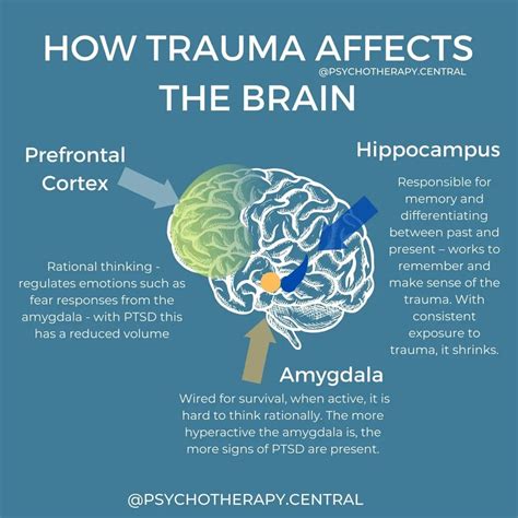 trauma affects  brain artofit
