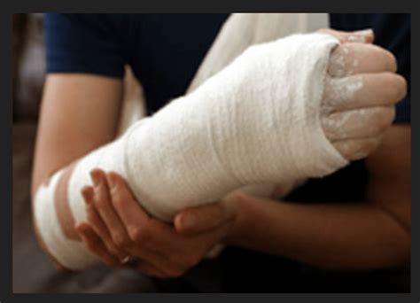 money   cost  fix  broken arm  health insurance
