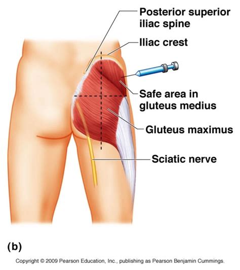 gluteal region anatomy  significance bone  spine