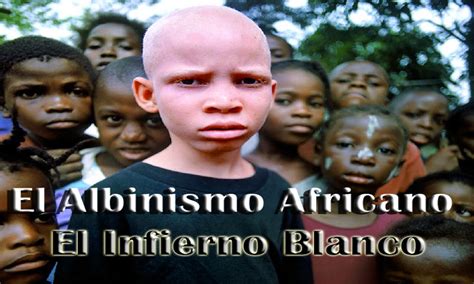 angelica italia los blancos negros documental de rt sobre albinos en africa