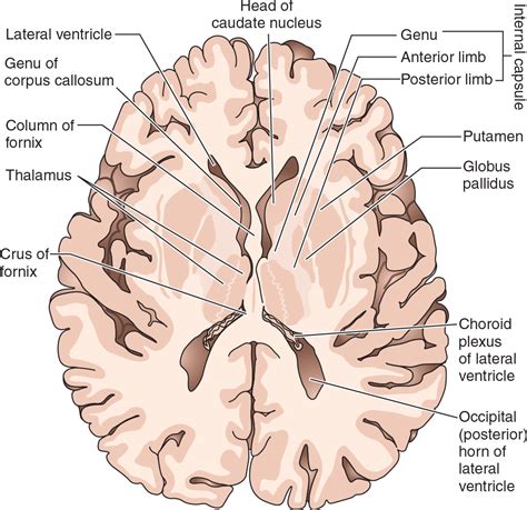 transverse section  brain labeled  xxx hot girl